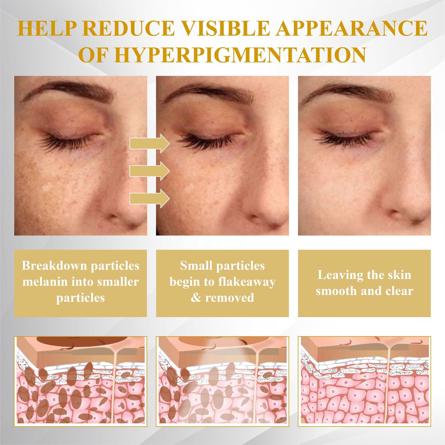 ATTDX® ClariBee Spot & Mole Corrective Cream