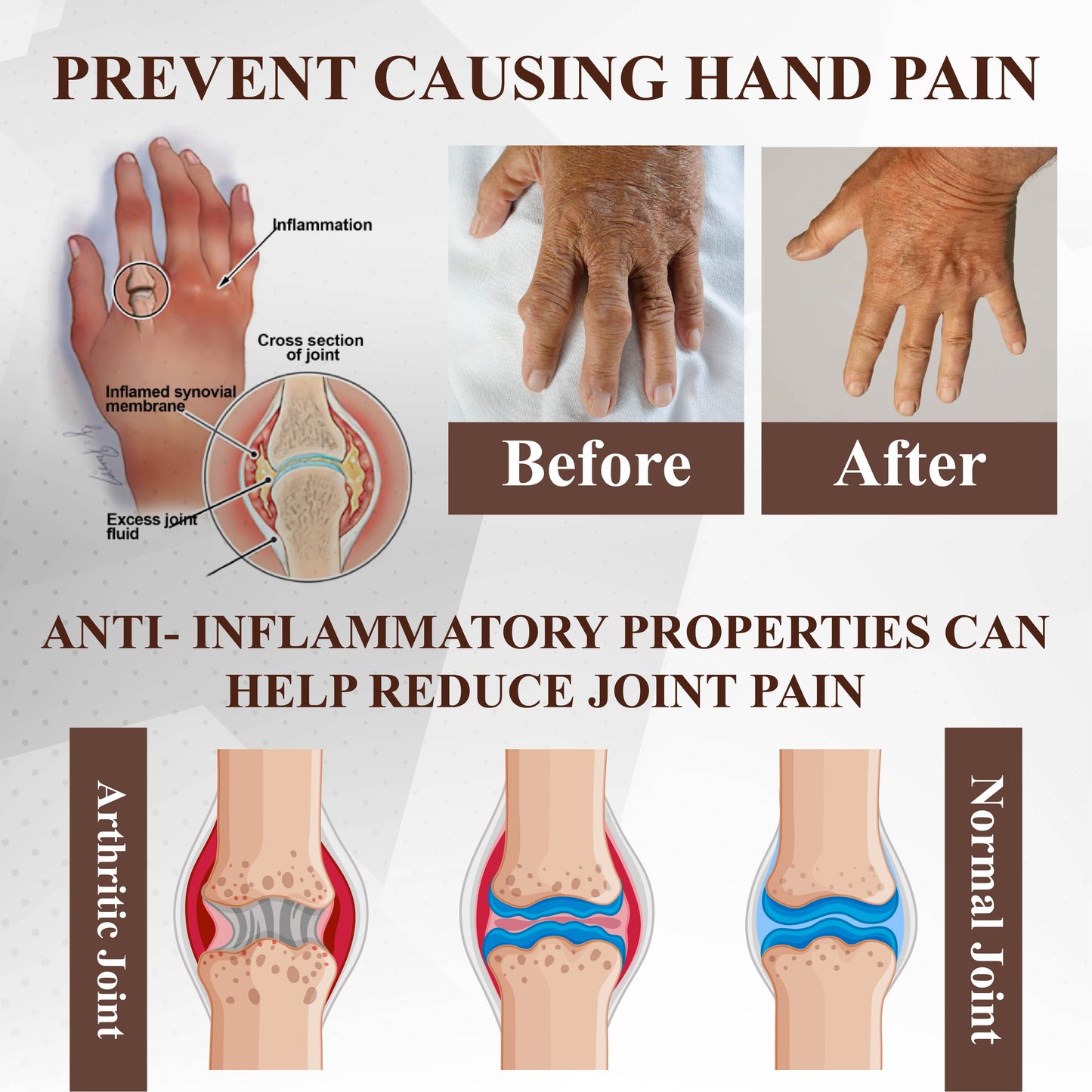 ATTDX® Emu Oil Turmeric Bone Sooth Gel 2